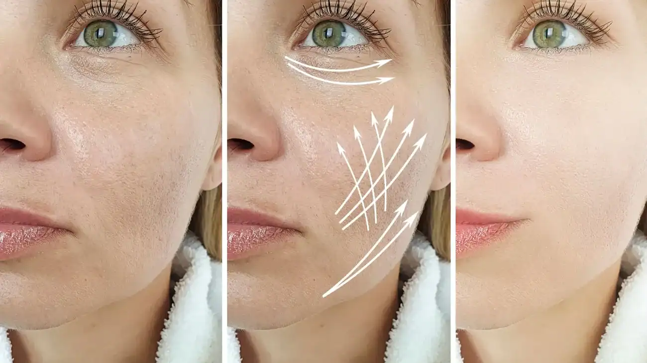 Can One Treatment Really Tackle More Than One Skin Concern Clacton?