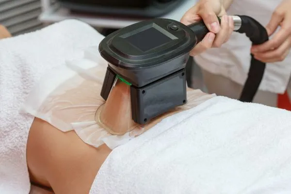 Image of person having fat freezing treatment to help weight gain Clacton