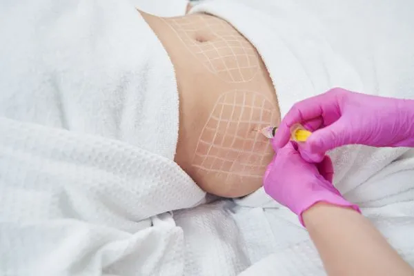 image of fat dissolving injections on love handles to help combat weight gain Clacton