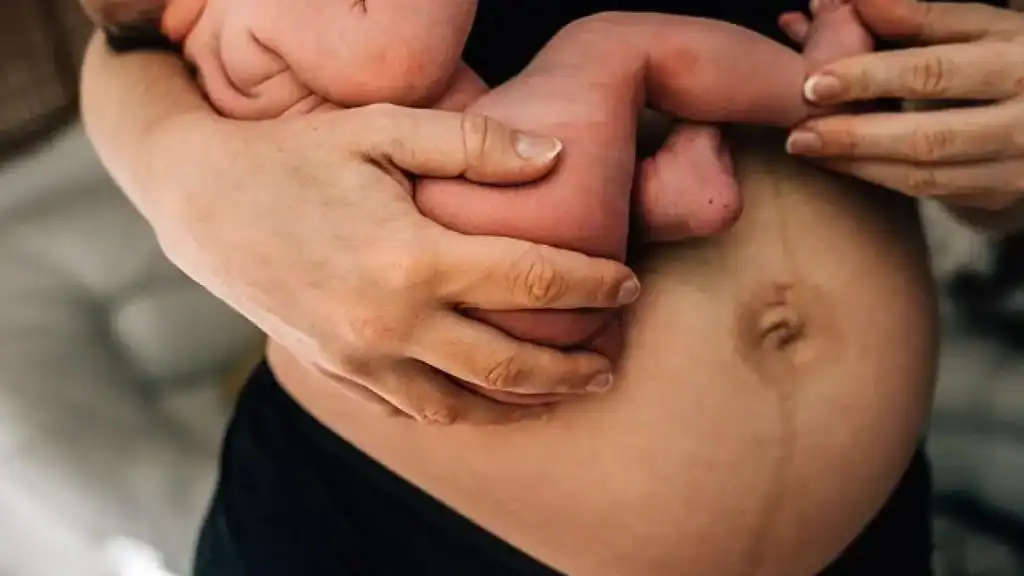 Why Is My Stomach Still Big After Pregnancy Clacton?
